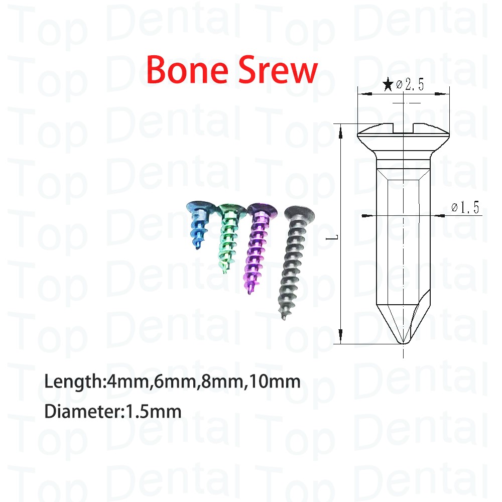 Sistema Dental GBR, tornillos  - Stabilizer Screw In reseña y precio
